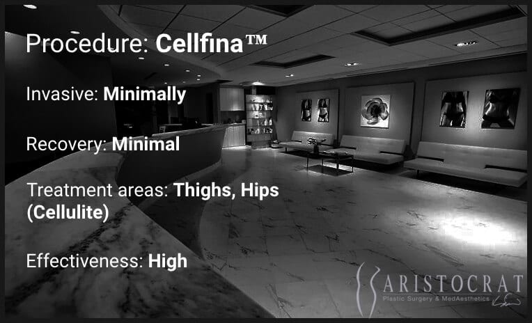 Cellfina procedure description