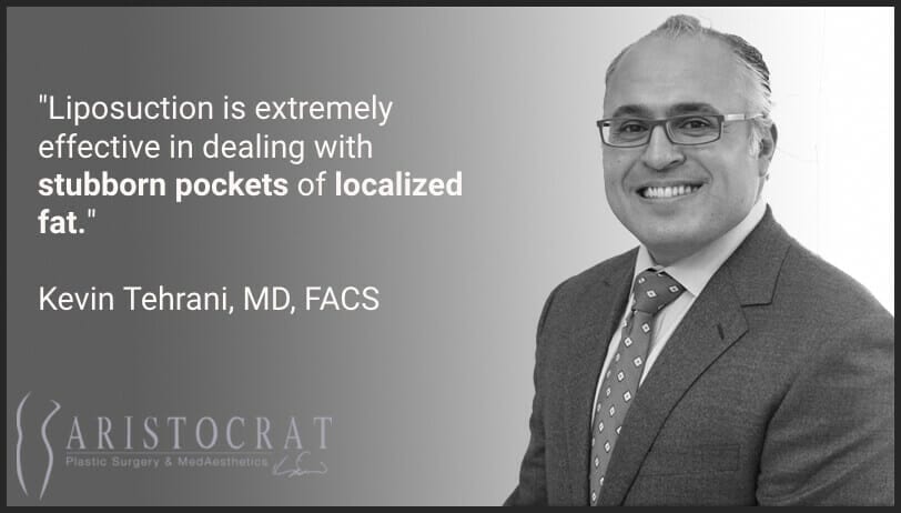 Dr. Tehrani quote on liposuction alternatives