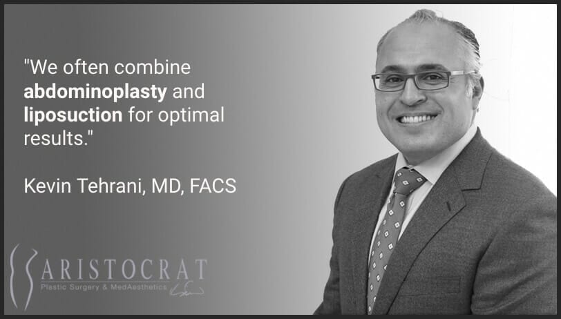 Dr. Tehrani quote on liposuction alternatives3