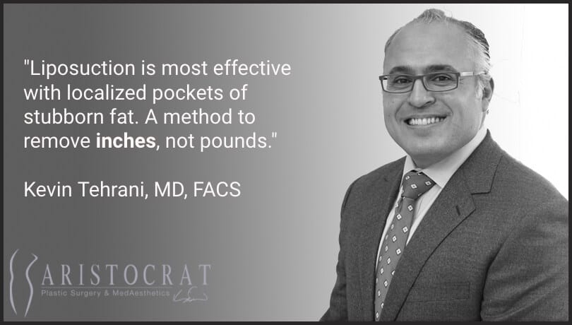 Dr. Tehrani quote on liposuction recovery3