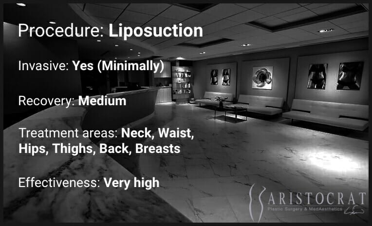 Liposuction procedure description
