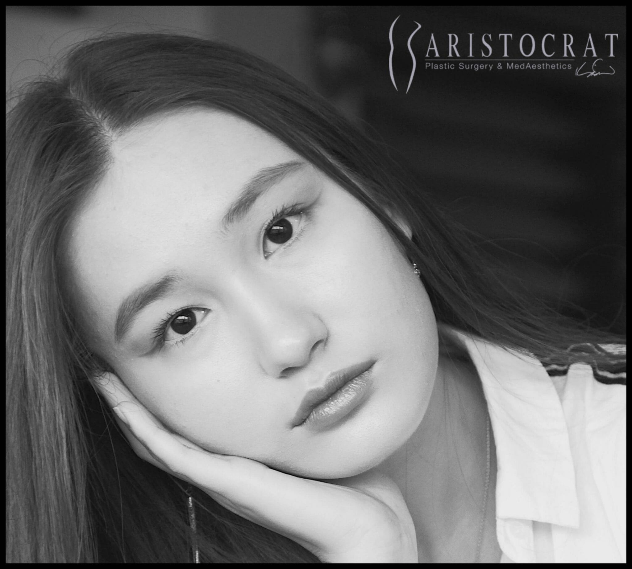 asian_rhinoplasty_5