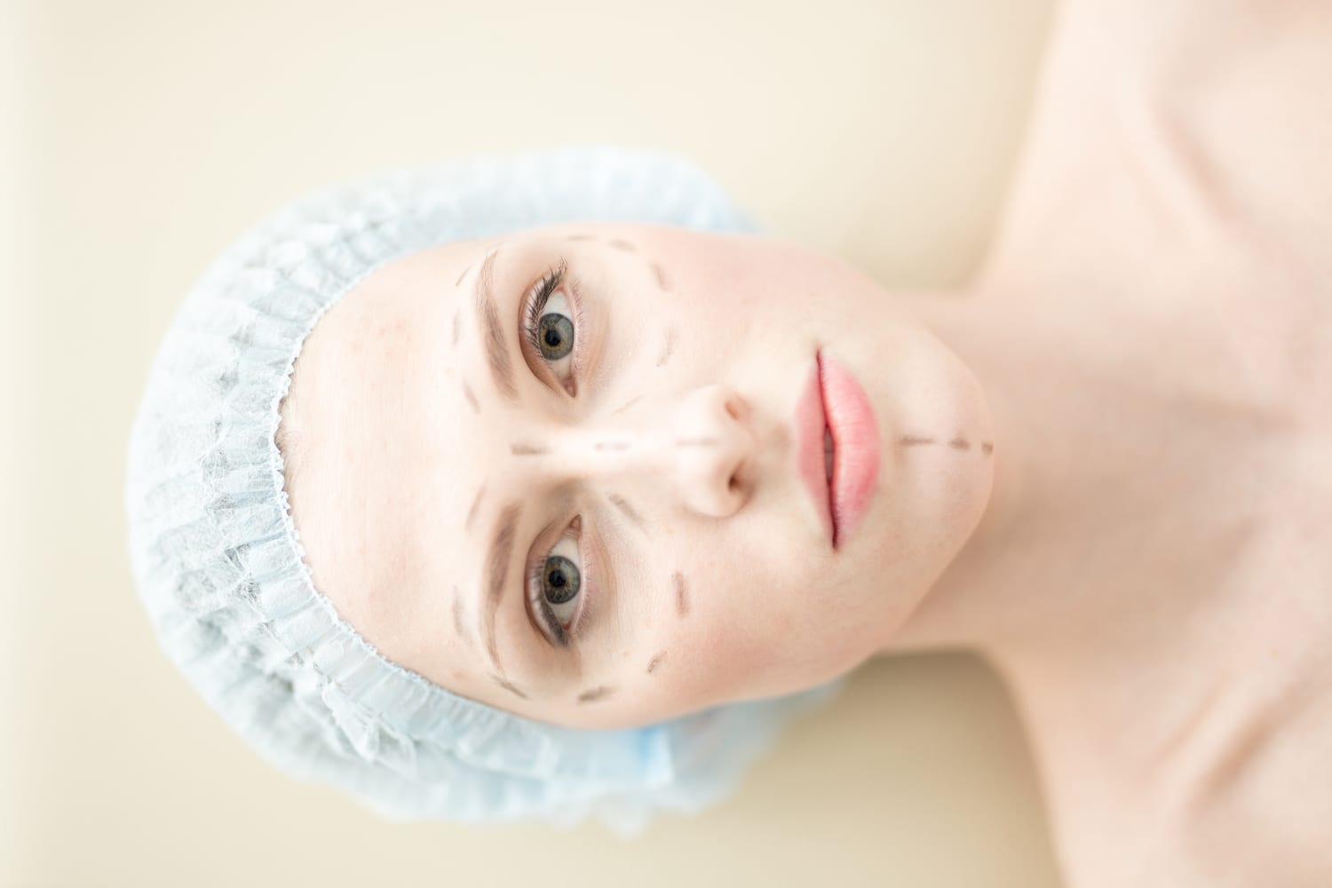 woman laying on an operating table with pre-surgery marks on her face