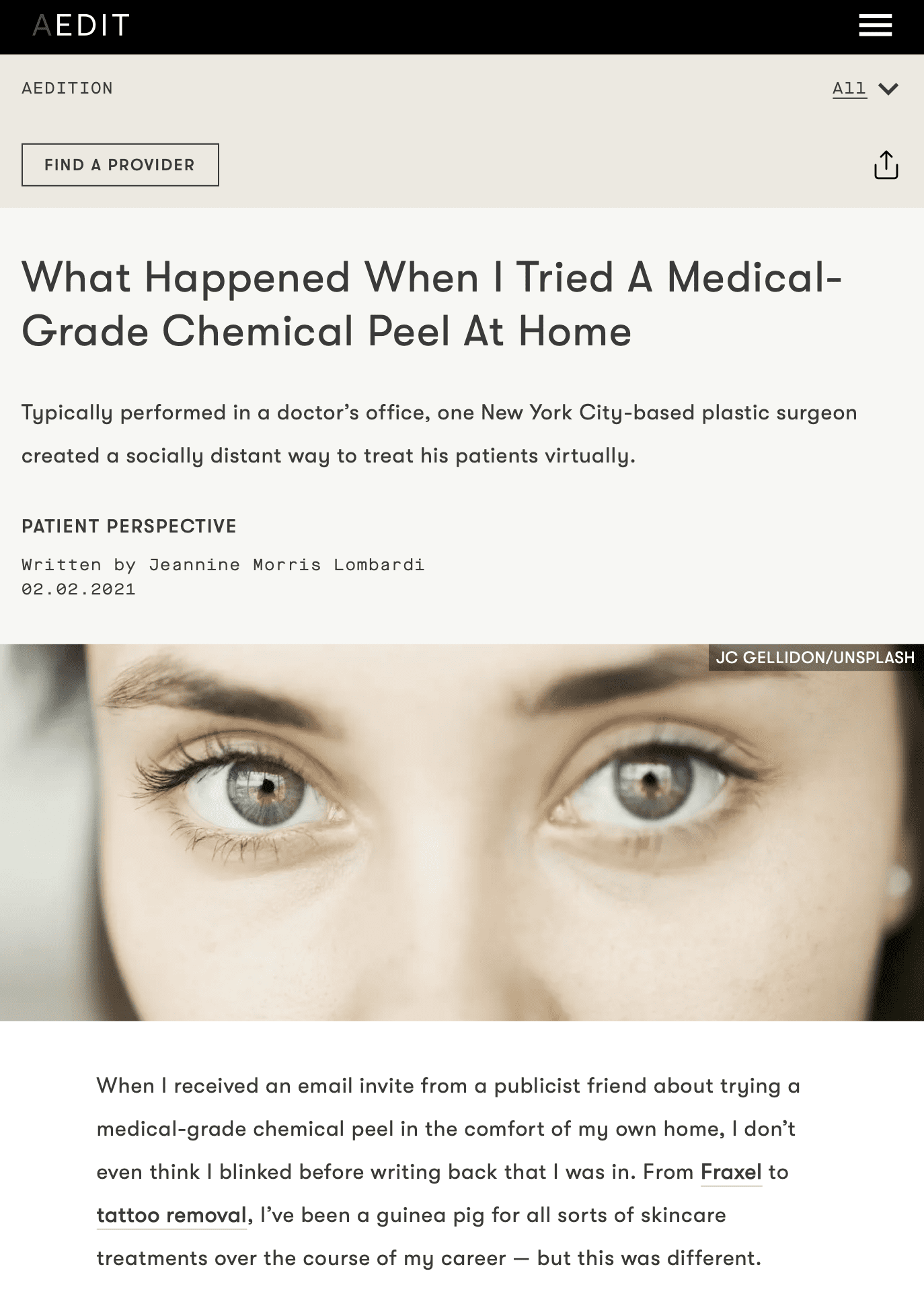 what-happened-when-i-tried-a-medical-grade-chemical-peel-at-home-_-aedition