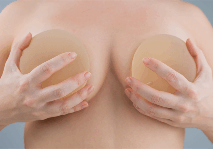 Breast Implants in Manhattan and Great Neck, NY - Aristocrat Plastic Surgery