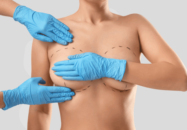 What-Is-TUBA-Breast-Augmentation